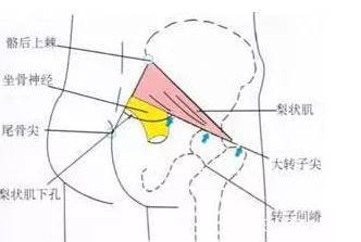 先坐骨神经疼再腰疼怎么回事(腰疼引起的坐骨神经疼用啥药)-第2张图片-