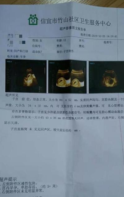 怀孕2个月出血是什么原因(怀孕4个月有点出血是什么原因)-第1张图片-